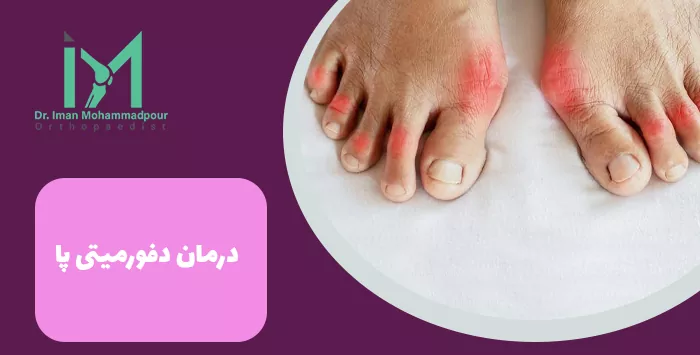 درمان دفورمیتی پا