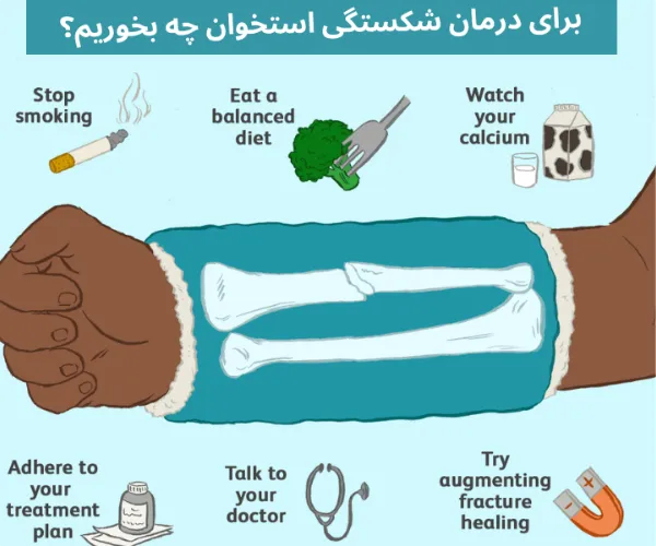 بهترین خوراکی های مفید برای درمان شکستگی استخوان