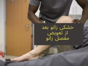 خشکی زانو بعد از تعویض مفصل زانو