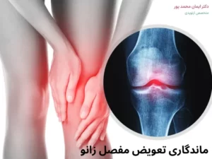 طول عمر تعویض مفصل زانو