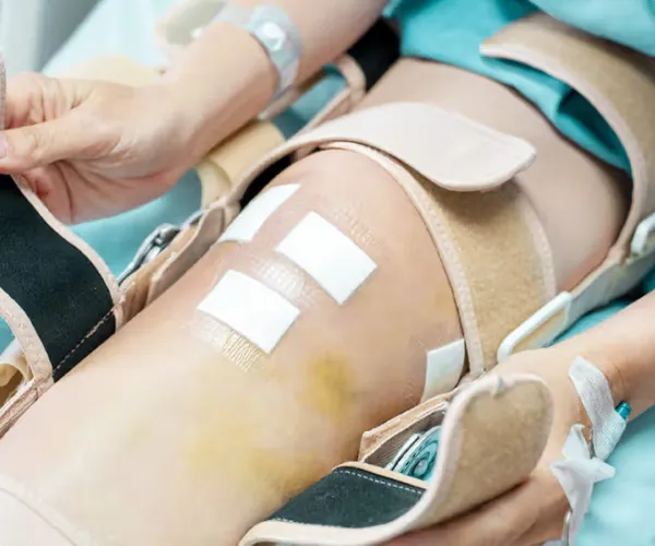 علت صدا دادن زانو بعد از تعویض مفصل زانو