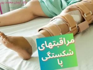 مراقبتهای بعد از شکستگی استخوان پا