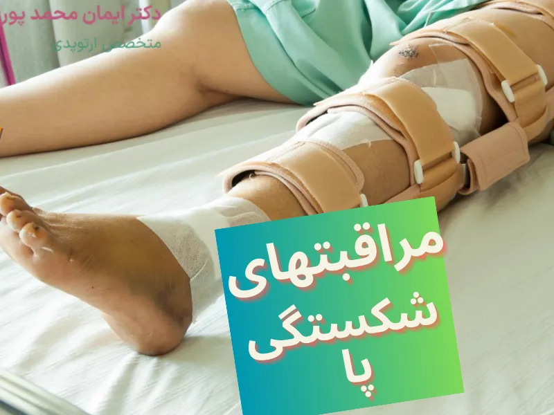 مراقبتهای بعد از شکستگی استخوان پا
