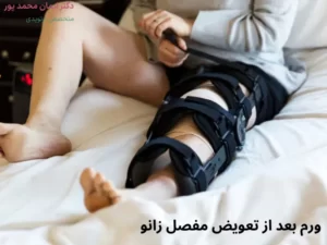 ورم بعد از تعویض مفصل زانو