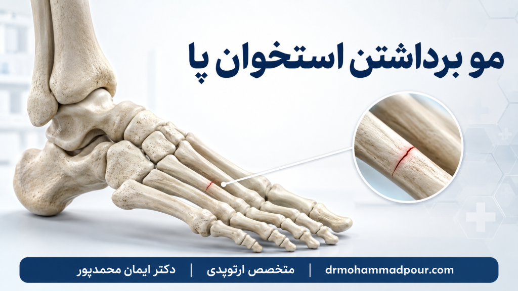 مو برداشتن استخوان پا
