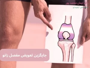 جایگزین تعویض مفصل زانو