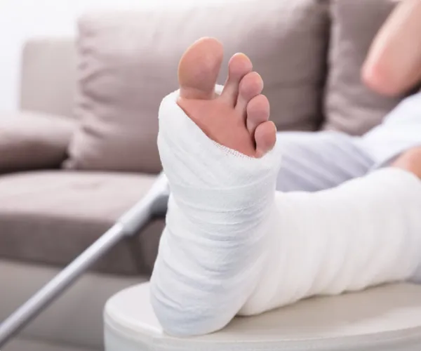 چگونه بعد از شکستگی پا راه برویم؟