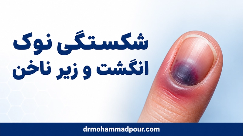 شکستگی نوک انگشت و زیر ناخن