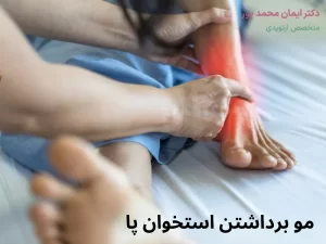 مو برداشتن استخوان پا