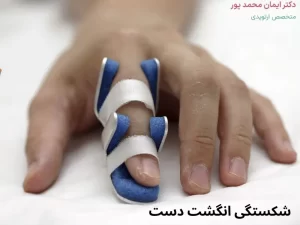 شکستگی انگشت دست