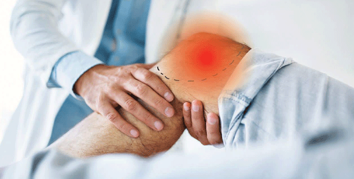 علت و علائم پارگی مینیسک زانو