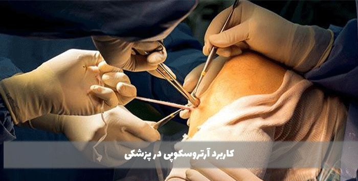 کاربرد آرتروسکوپی در پزشکی چیست؟