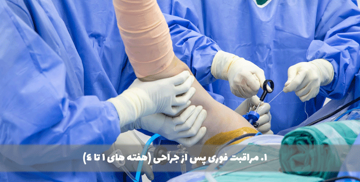 1. مراقبت فوری پس از جراحی (هفته های 1 تا 4)