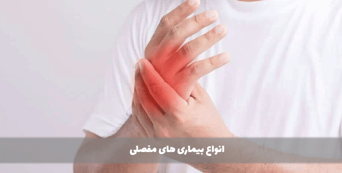 انواع بیماری های مفصلی