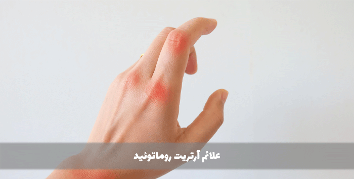 علائم آرتریت روماتوئید