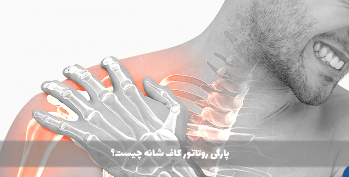 پارگی روتاتور کاف شانه چیست؟