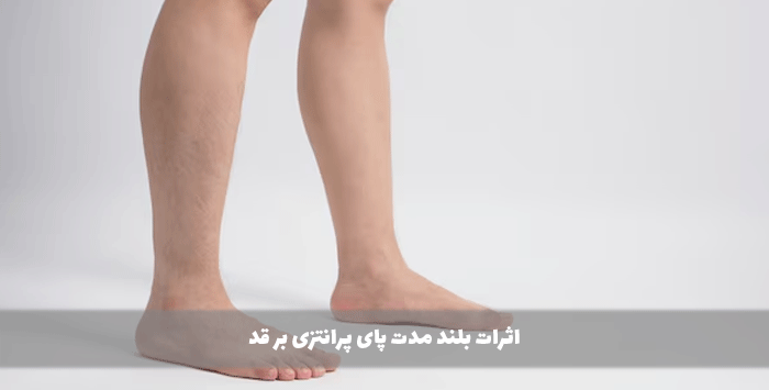 اثرات بلند مدت پای پرانتزی بر قد