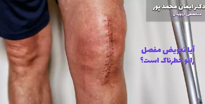 آیا تعویض مفصل زانو خطرناک است؟