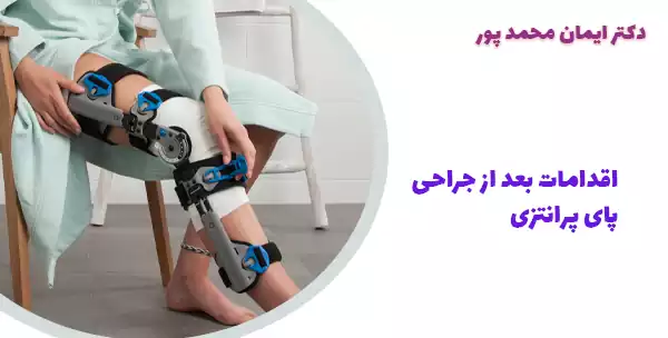 اقدامات بعد از جراحی پای پرانتزی