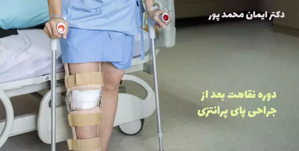 دوره نقاهت بعد از جراحی پای پرانتزی