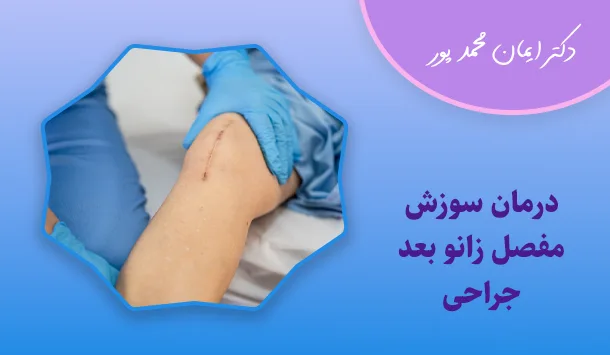 درمان سوزش مفصل زانو بعد جراحی