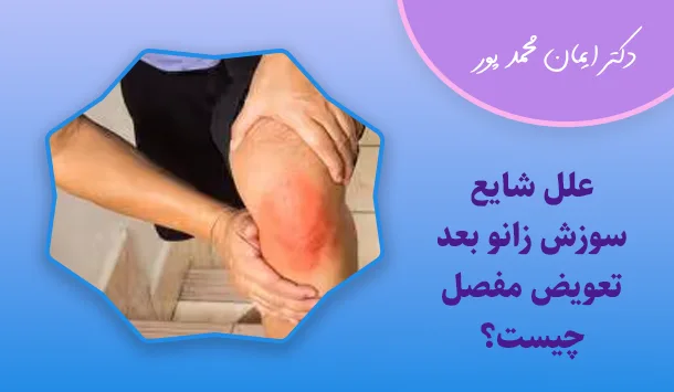 علل شایع سوزش زانو بعد تعویض مفصل چیست؟