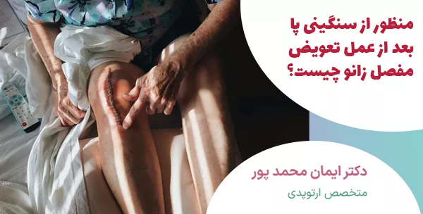 منظور از سنگینی پا بعد از عمل تعویض مفصل زانو چیست؟