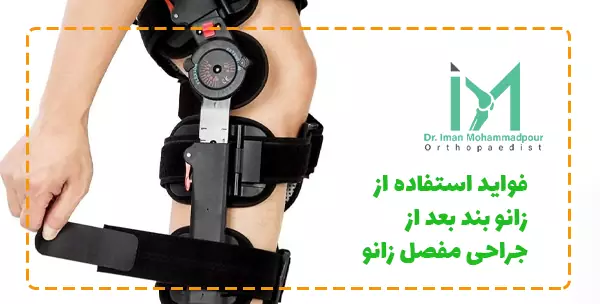 فواید استفاده از زانو بند بعد از جراحی مفصل زانو