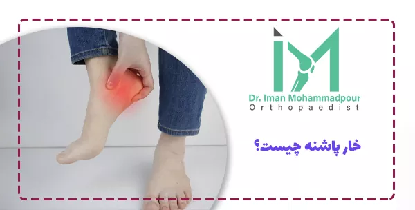 خار پاشنه چیست؟