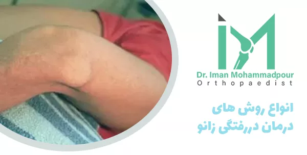 انواع روش های درمان دررفتگی زانو