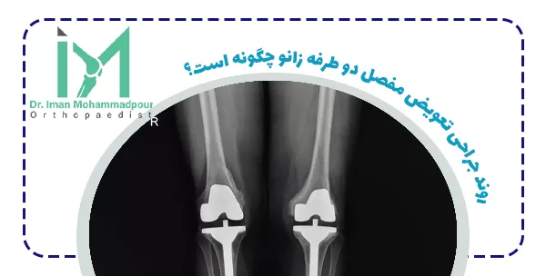 روند جراحی تعویض مفصل دو طرفه زانو چگونه است؟
