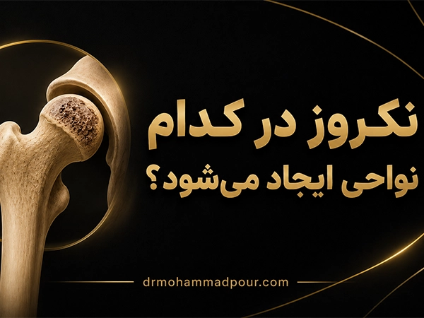 نواحی ایجاد نکروز