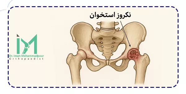 نکروز