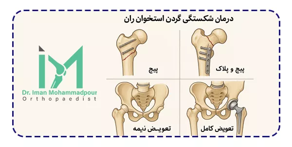 چه درمان هایی برای شکستگی گردن استخوان ران وجود دارد؟