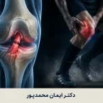 راه رفتن با رباط صلیبی پاره