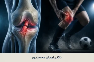 راه رفتن با رباط صلیبی پاره