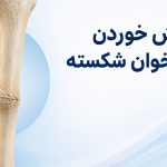جوش خوردن استخوان