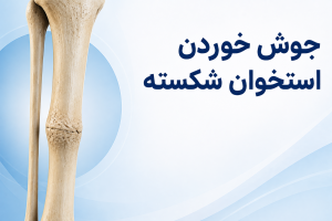 جوش خوردن استخوان