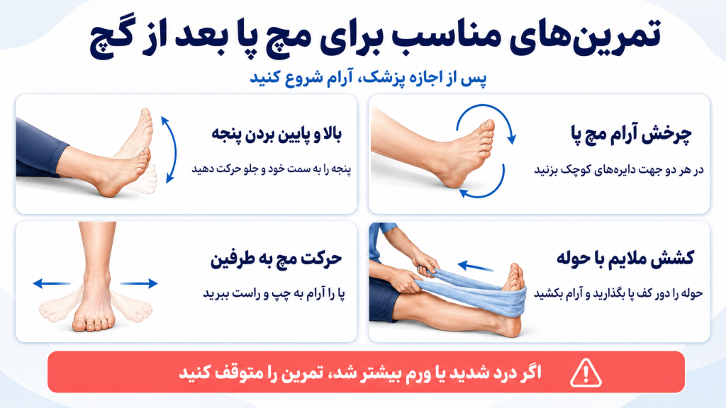تمرین های مناسب برای مچ پا بعد از گچ