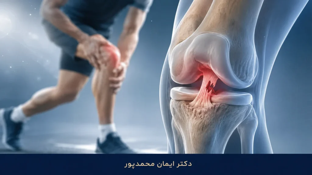 راه رفتن با رباط صلیبی پاره