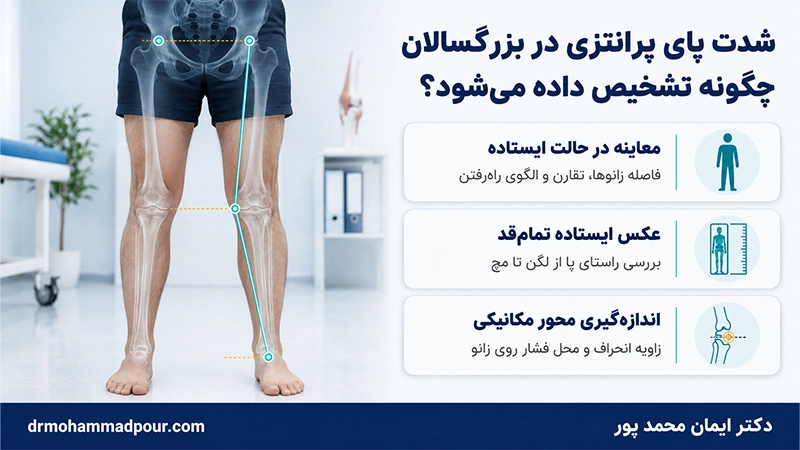 تشخیص شدت پای پرانتزی